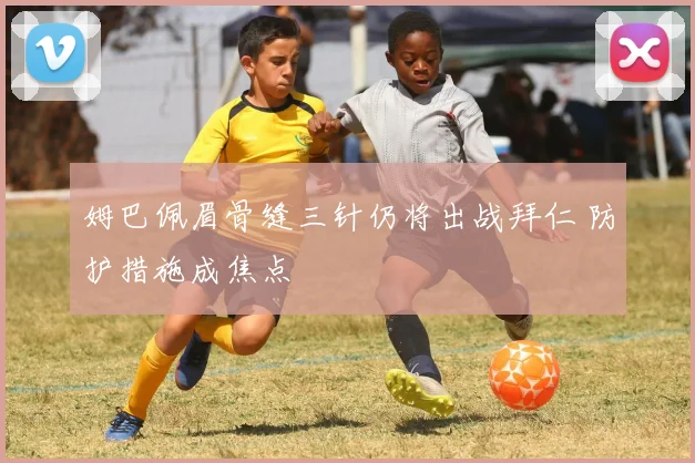 姆巴佩眉骨缝三针仍将出战拜仁 防护措施成焦点